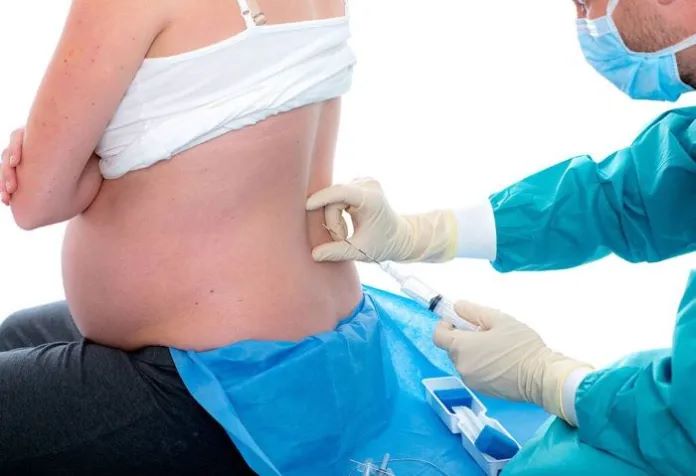 About Epidural Injection for Delivery Pain