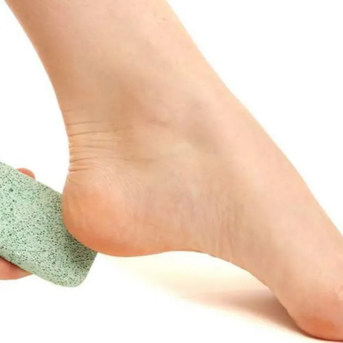 Benefits of Pumice Stone and Use – What Is A Pumice Stone