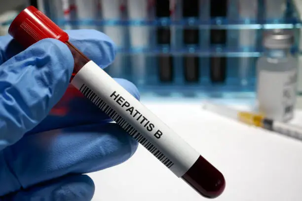 Hepatitis B Treatment – Hepatitis B Symptoms and Ways to Prevent