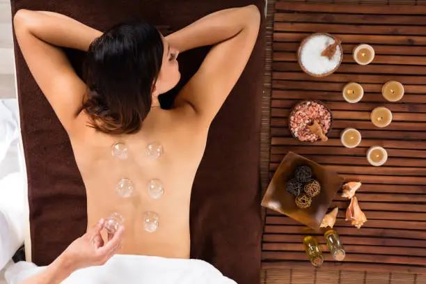 Benefits of Cupping Therapy and Side Effects – Benefits of Hijama